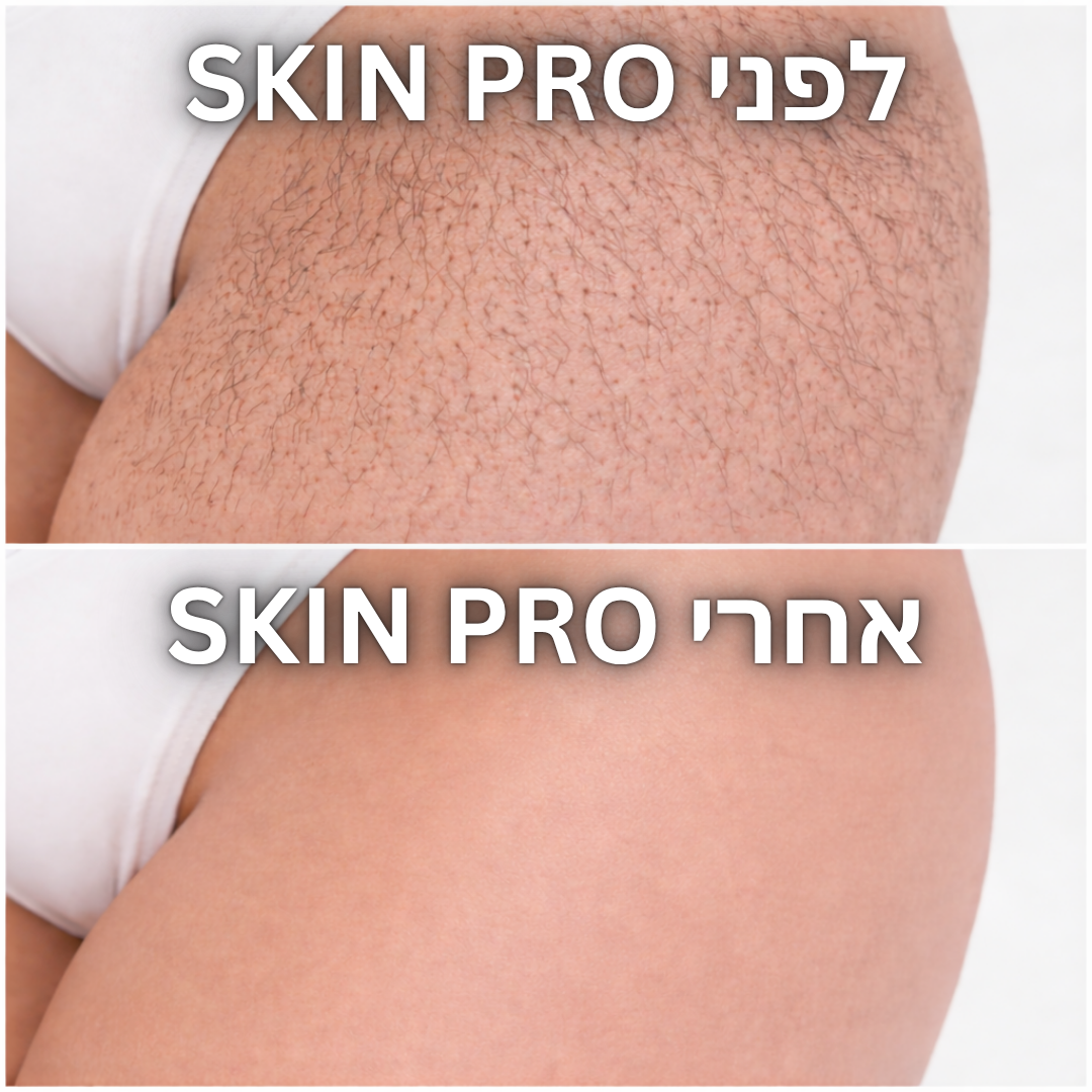 המסיר שיער של SkinPro
